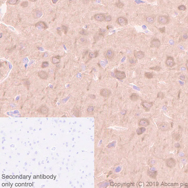 Immunohistochemistry (Formalin/PFA-fixed paraffin-embedded sections) - Anti-Stathmin 1 antibody [EP1573Y] - BSA and Azide free (AB221017)