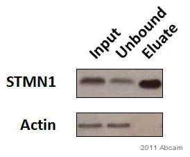 Immunoprecipitation - Anti-Stathmin 1 antibody [EP1573Y] - BSA and Azide free (AB221017)