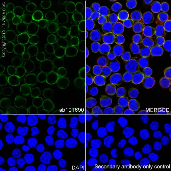 Immunocytochemistry/ Immunofluorescence - Anti-Stathmin 1 antibody [SP49] (AB101690)