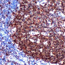 Immunohistochemistry (Formalin/PFA-fixed paraffin-embedded sections) - Anti-Stathmin 1 antibody [SP49] (AB101690)