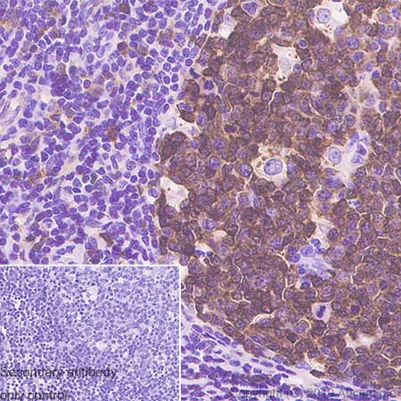 Immunohistochemistry (Formalin/PFA-fixed paraffin-embedded sections) - Anti-Stathmin 1 antibody [SP49] (AB101690)