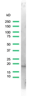 Western blot - Anti-Stathmin 1 antibody [SP49] (AB101690)