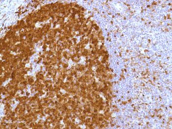 Immunohistochemistry (Formalin/PFA-fixed paraffin-embedded sections) - Anti-Stathmin 1 antibody [SP49], prediluted (AB228139)