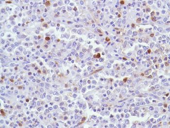Immunohistochemistry (Formalin/PFA-fixed paraffin-embedded sections) - Anti-Stathmin 1 antibody [SP49], prediluted (AB228139)