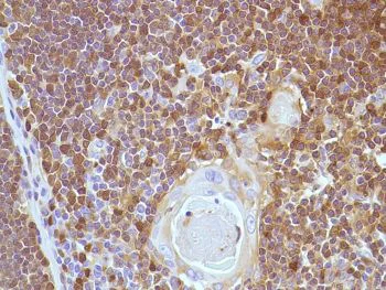 Immunohistochemistry (Formalin/PFA-fixed paraffin-embedded sections) - Anti-Stathmin 1 antibody [SP49], prediluted (AB228139)
