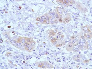Immunohistochemistry (Formalin/PFA-fixed paraffin-embedded sections) - Anti-Stathmin 1 antibody [SP49], prediluted (AB228139)