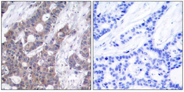 Immunohistochemistry (Formalin/PFA-fixed paraffin-embedded sections) - Anti-Stathmin 1 (phospho S16) antibody (AB47328)