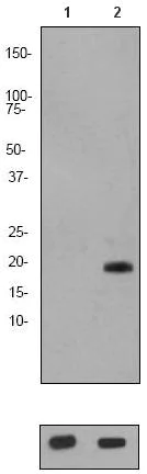 Western blot - Anti-Stathmin 1 (phospho S24) antibody [EP2124Y] (AB62336)