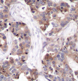 Immunohistochemistry (Formalin/PFA-fixed paraffin-embedded sections) - Anti-Stathmin 1 (phospho S25) antibody (AB194752)