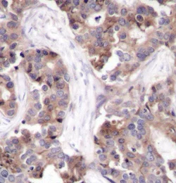 Immunohistochemistry (Formalin/PFA-fixed paraffin-embedded sections) - Anti-Stathmin 1 (phospho S25) antibody (AB194752)
