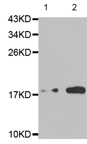 Western blot - Anti-Stathmin 1 (phospho S25) antibody (AB194752)