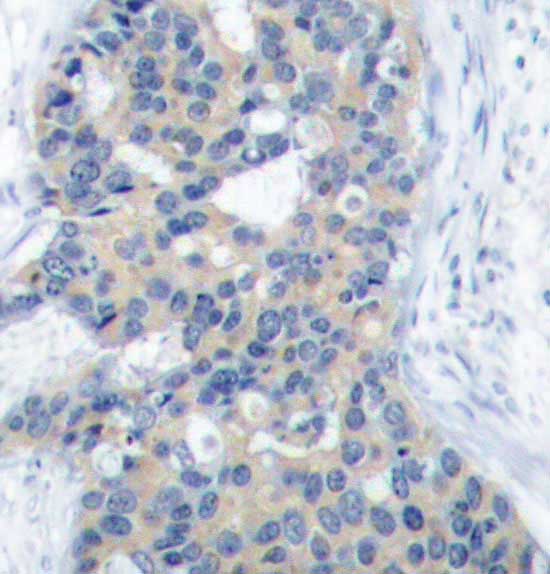 Immunohistochemistry (Formalin/PFA-fixed paraffin-embedded sections) - Anti-Stathmin 1 (phospho S38) antibody (AB194757)
