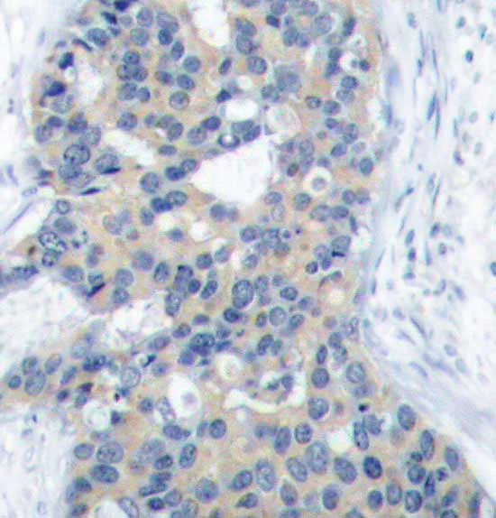 Immunohistochemistry (Formalin/PFA-fixed paraffin-embedded sections) - Anti-Stathmin 1 (phospho S38) antibody (AB194757)