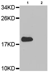 Western blot - Anti-Stathmin 1 (phospho S38) antibody (AB194757)