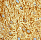 Immunohistochemistry (Formalin/PFA-fixed paraffin-embedded sections) - Anti-Stathmin 1 (phospho S63) antibody [EPR1574] (AB76583), expandable thumbnail