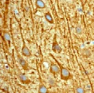 Immunohistochemistry (Formalin/PFA-fixed paraffin-embedded sections) - Anti-Stathmin 1 (phospho S63) antibody [EPR1574] (AB76583)