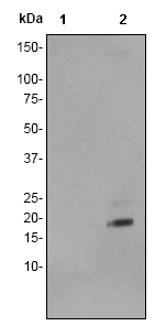 Western blot - Anti-Stathmin 1 (phospho S63) antibody [EPR1574] (ab76583), expandable thumbnail