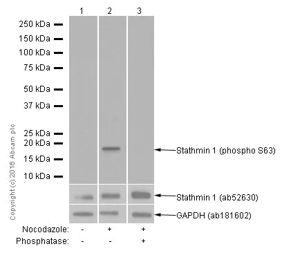Western blot - Anti-Stathmin 1 (phospho S63) antibody [EPR1574] (AB76583)