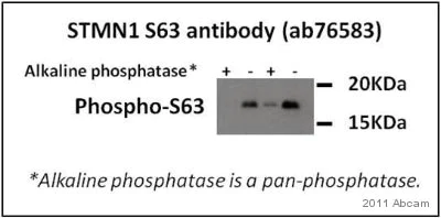 Western blot - Anti-Stathmin 1 (phospho S63) antibody [EPR1574] (AB76583)