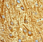 Immunohistochemistry (Formalin/PFA-fixed paraffin-embedded sections) - Anti-Stathmin 1 (phospho S63) antibody [EPR1574] - BSA and Azide free (AB239888), expandable thumbnail