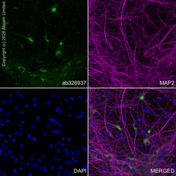 Immunocytochemistry/ Immunofluorescence - Anti-Stathmin-2/STMN2 antibody [EPR31028-544] - BSA and Azide free (AB328102)