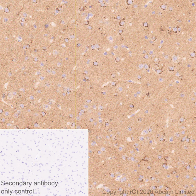 Immunohistochemistry (Formalin/PFA-fixed paraffin-embedded sections) - Anti-Stathmin-2/STMN2 antibody [EPR31028-544] - BSA and Azide free (AB328102)