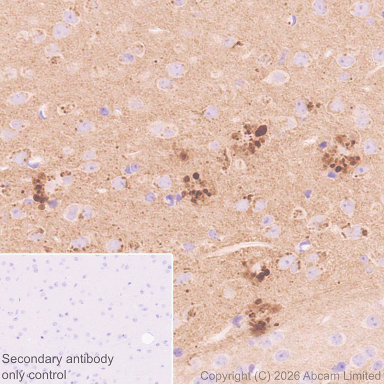 Immunohistochemistry (Formalin/PFA-fixed paraffin-embedded sections) - Anti-Stathmin-2/STMN2 antibody [EPR31028-544] - BSA and Azide free (AB328102)