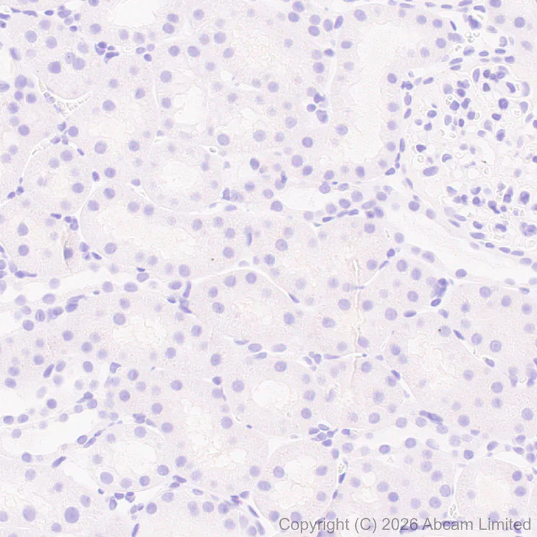 Immunohistochemistry (Formalin/PFA-fixed paraffin-embedded sections) - Anti-Stathmin-2/STMN2 antibody [EPR31028-544] - BSA and Azide free (AB328102)