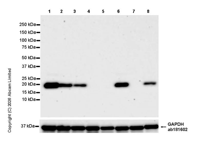 Western blot - Anti-Stathmin-2/STMN2 antibody [EPR31028-544] - BSA and Azide free (AB328102)