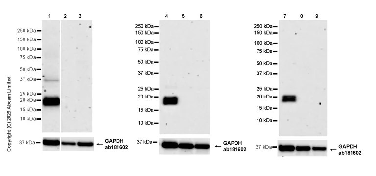 Western blot - Anti-Stathmin-2/STMN2 antibody [EPR31028-544] - BSA and Azide free (AB328102)