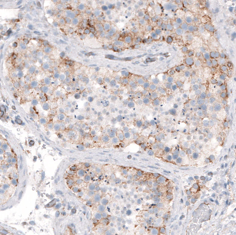 Immunohistochemistry (Formalin/PFA-fixed paraffin-embedded sections) - Anti-STAU2 antibody (AB246918)
