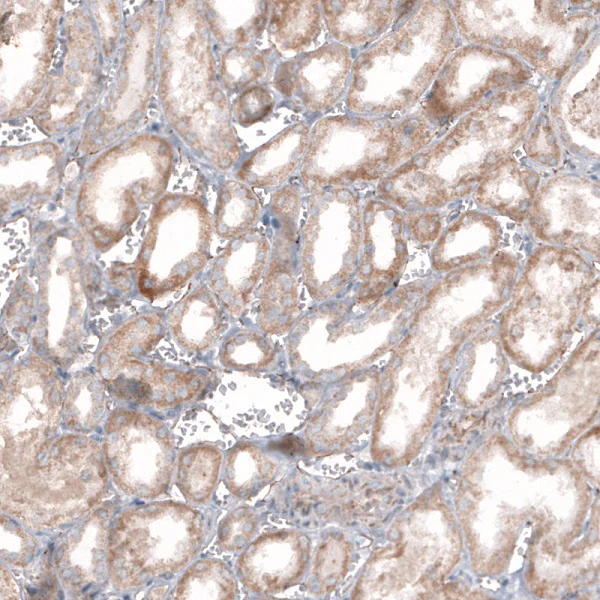 Immunohistochemistry (Formalin/PFA-fixed paraffin-embedded sections) - Anti-STAU2 antibody (AB246918)