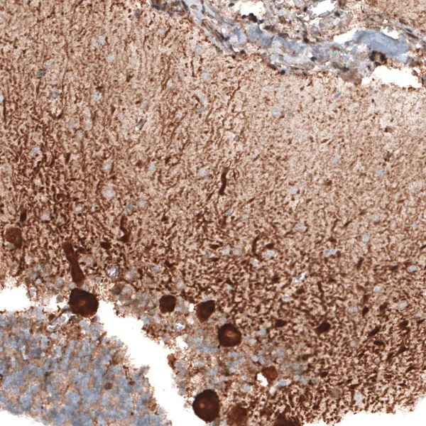 Immunohistochemistry (Formalin/PFA-fixed paraffin-embedded sections) - Anti-STAU2 antibody (AB246918)