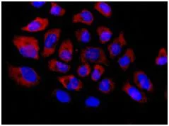 Immunocytochemistry/ Immunofluorescence - Anti-Staufen/STAU1 antibody [EPR7966] (AB137100)