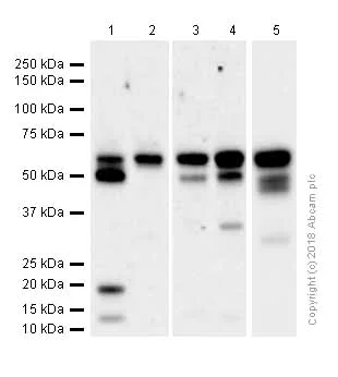 Western blot - Anti-Staufen/STAU1 antibody [EPR7966] (AB137100)