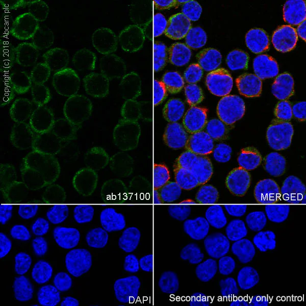 Immunocytochemistry/ Immunofluorescence - Anti-Staufen/STAU1 antibody [EPR7966] - BSA and Azide free (AB240107)
