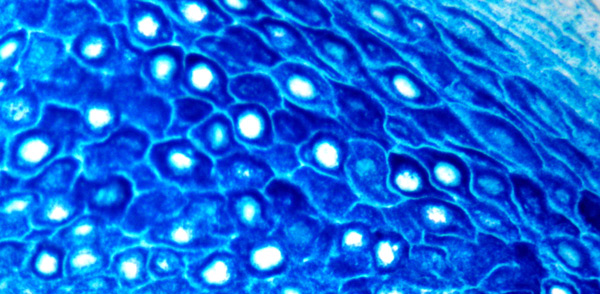 Immunohistochemistry (Formalin/PFA-fixed paraffin-embedded sections) - StayBlue/AP Plus (AB176915), expandable thumbnail
