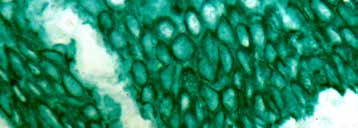 Immunohistochemistry (Formalin/PFA-fixed paraffin-embedded sections) - StayGreen/AP Plus (Alcohol and Xylene Substitute Compatible) (AB156428), expandable thumbnail