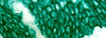 Immunohistochemistry (Formalin/PFA-fixed paraffin-embedded sections) - StayGreen/AP Plus (Alcohol and Xylene Substitute Compatible) (AB156428)