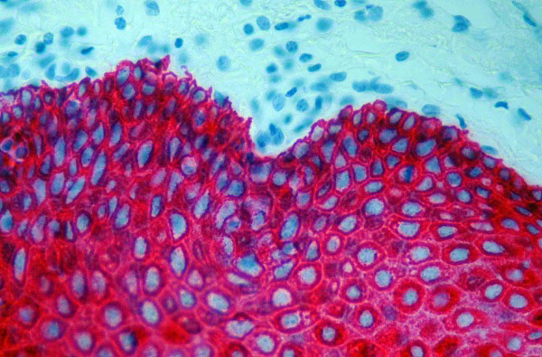 Immunohistochemistry (Formalin/PFA-fixed paraffin-embedded sections) - StayRed/AP 30ml (Alcohol & Xylene Compatible) (AB103741), expandable thumbnail