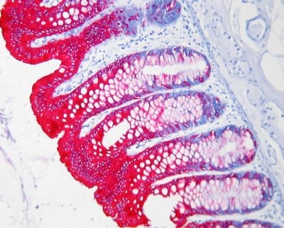 Immunohistochemistry (Formalin/PFA-fixed paraffin-embedded sections) - StayRed/AP 30ml (Alcohol & Xylene Compatible) (AB103741), expandable thumbnail