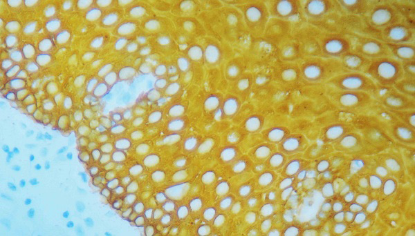 Immunohistochemistry (Formalin/PFA-fixed paraffin-embedded sections) - StayYellow/HRP (AB169561), expandable thumbnail