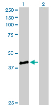 Western blot - Anti-STBD1 antibody (AB172352), expandable thumbnail