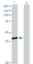 Western blot - Anti-STBD1 antibody (AB172352)