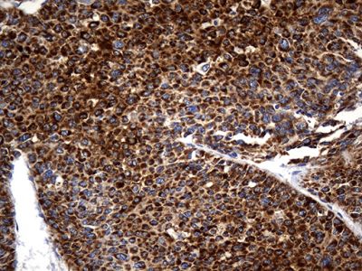 Immunohistochemistry (Formalin/PFA-fixed paraffin-embedded sections) - Anti-STBD1 antibody [OTI2F1] (AB236416), expandable thumbnail