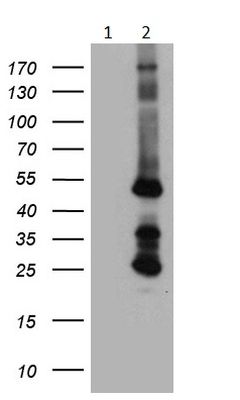 Western blot - Anti-STBD1 antibody [OTI2F1] (AB236416), expandable thumbnail