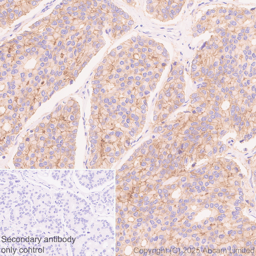 Immunohistochemistry (Formalin/PFA-fixed paraffin-embedded sections) - Anti-STEAP1 antibody [EPR29701-75] (ab324263), expandable thumbnail
