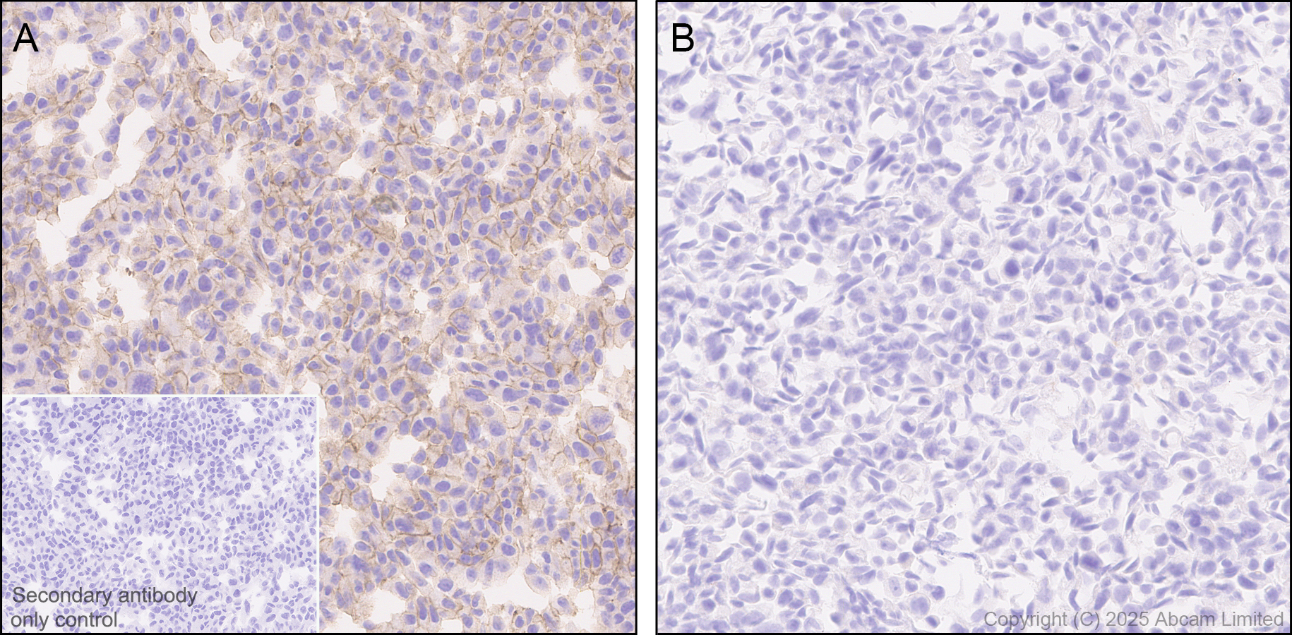 Immunohistochemistry (Formalin/PFA-fixed paraffin-embedded sections) - Anti-STEAP1 antibody [EPR29701-75] (AB324263), expandable thumbnail