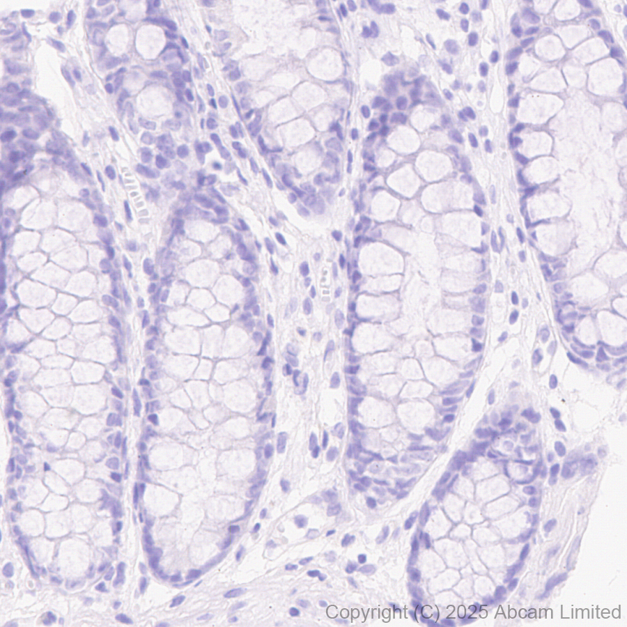 Immunohistochemistry (Formalin/PFA-fixed paraffin-embedded sections) - Anti-STEAP1 antibody [EPR29701-75] (AB324263), expandable thumbnail