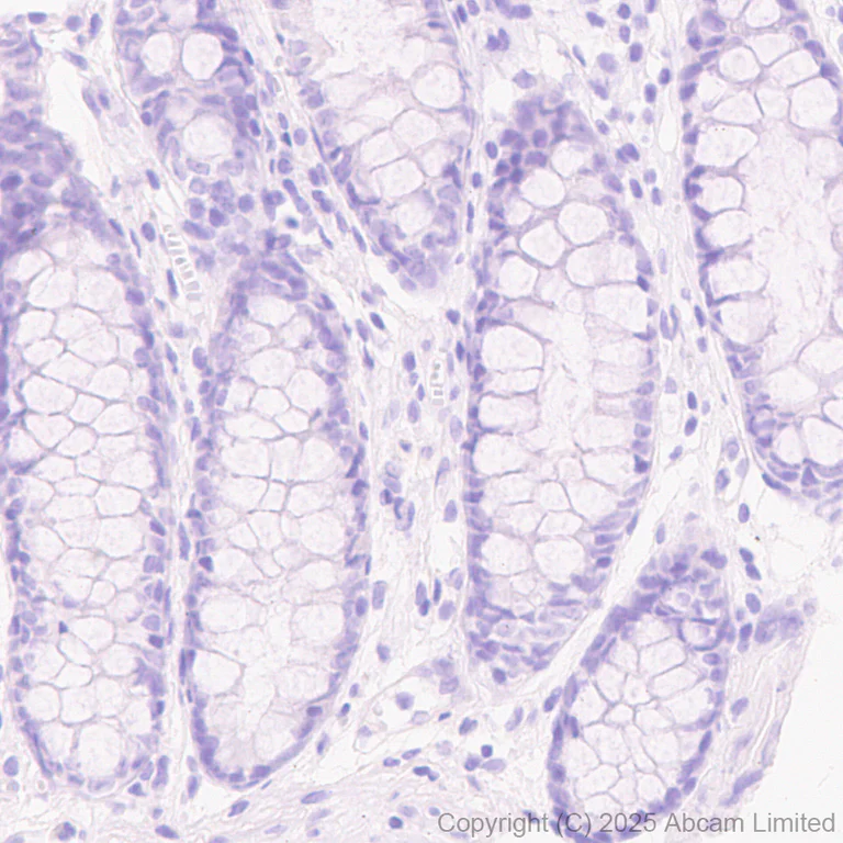Immunohistochemistry (Formalin/PFA-fixed paraffin-embedded sections) - Anti-STEAP1 antibody [EPR29701-75] (AB324263)